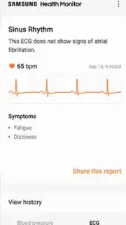 Samsung Health Monitor Screenshot 1