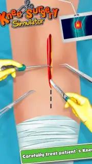 KneeSurgery Screenshot 2