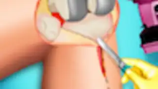 KneeSurgery